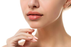 Woman with dermal fillers