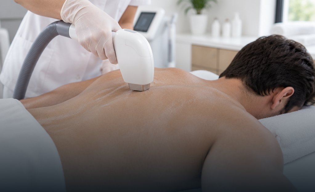Laser hair removal on the back