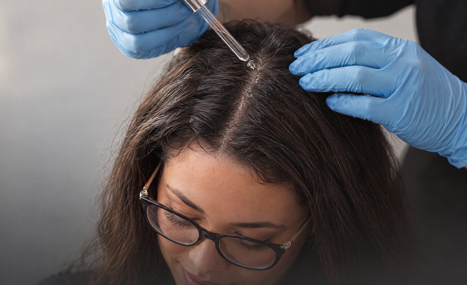 Provider applying a scalp treatment along the part